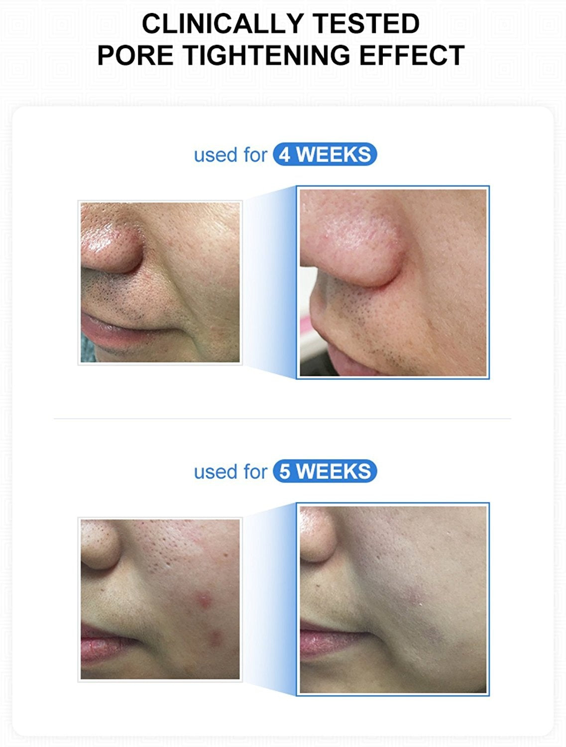 Medicube Zero Pore Pad 2.0 cleansing facial pads