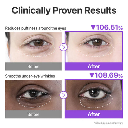 Numbuzin No.9 NAD+ Collagen Under Eye Patches - 5 pāri