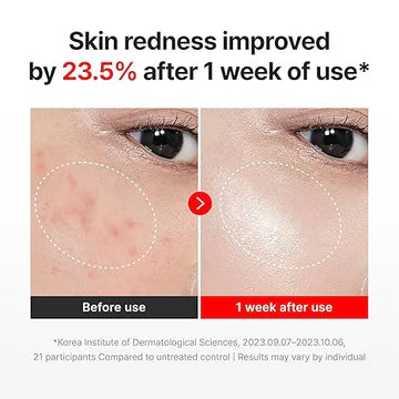 Centellian24 Madeca Cream Time Reverse