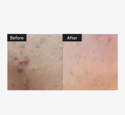 Reedle Shot 100 sejas serums ar mikroadatām – VT Cosmetics
